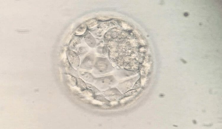 Tipos de células madre