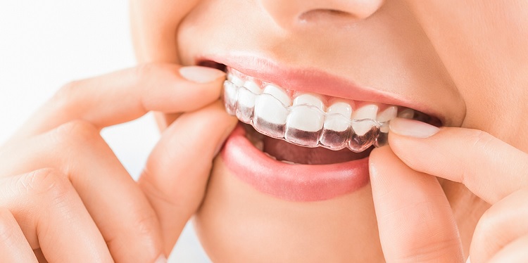 La Clínica Dental Nieto & Llorens Tu mejor opción para una ortodoncia invisible